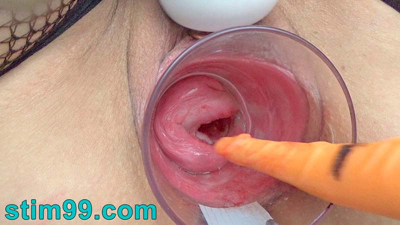 Extreme gaped cervix fucking with dildo