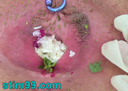 Cervix inserting stems of stinging nettles, causing extreme pain and burning by the urtication