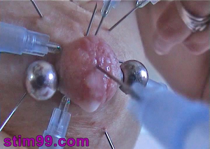 Nipple dripping milk while being pierced by needles