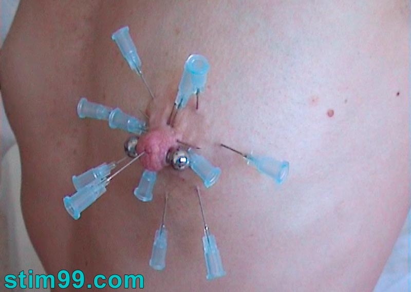 Nipple dripping milk while being pierced by needles