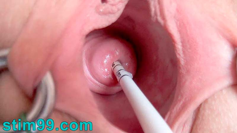 Real Extreme Cervix Fucking. Open wide pussy and sounding for dilatation