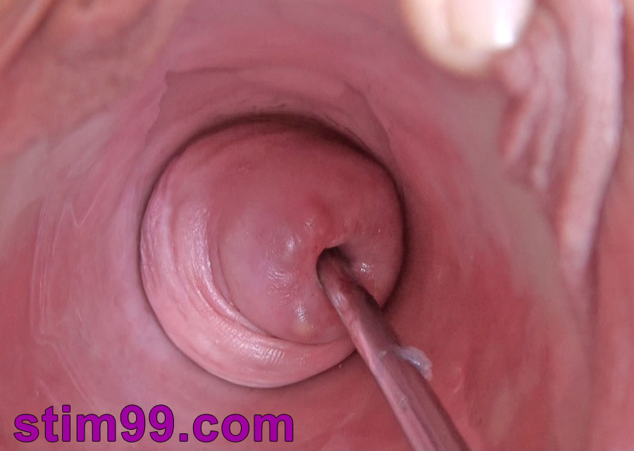 Open pussy wide and huge gapping cervix