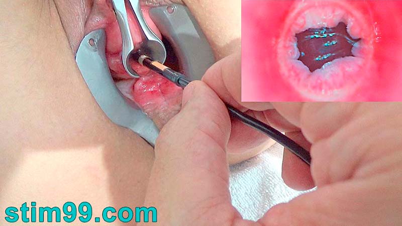 Endoskop in der Blase mit Sperma und Pissloch ficken mit Dildo