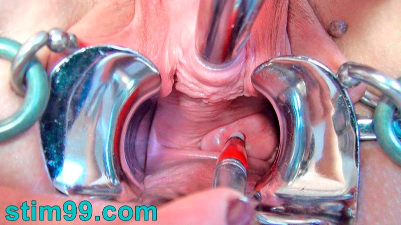 Extreme Cervix Play and Peehole Fucking at once
