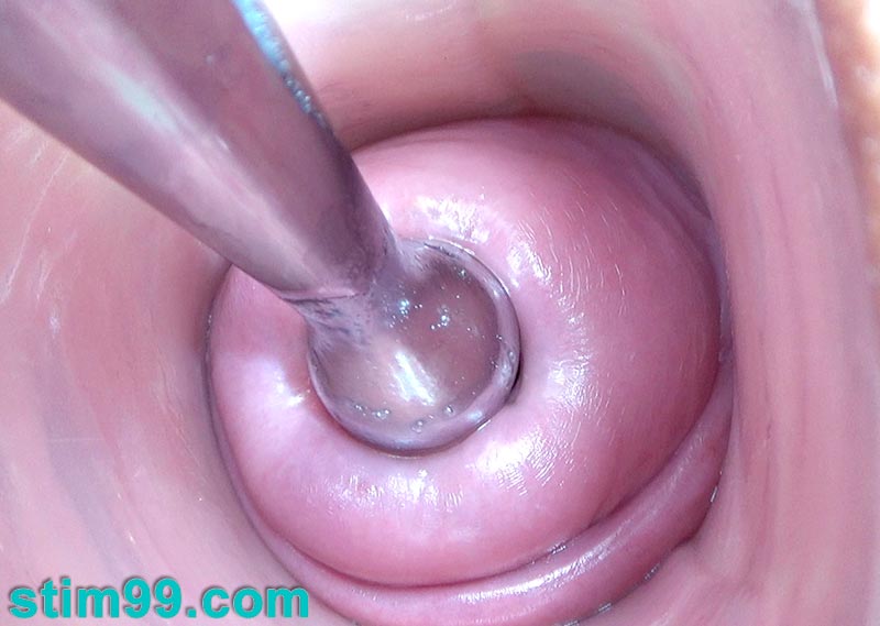 Metal dildo with a large ball to open wide cervix