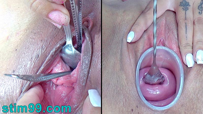 Lesbians Cervix and Urethral Fucking