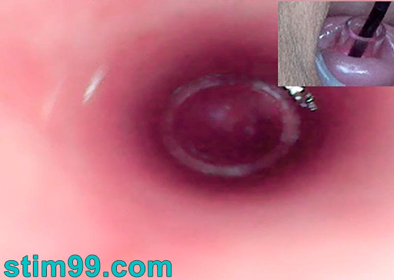 Trying watch uterus with endoscope camera