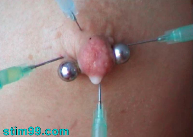 Masochist girl saline injection directly into the nipples