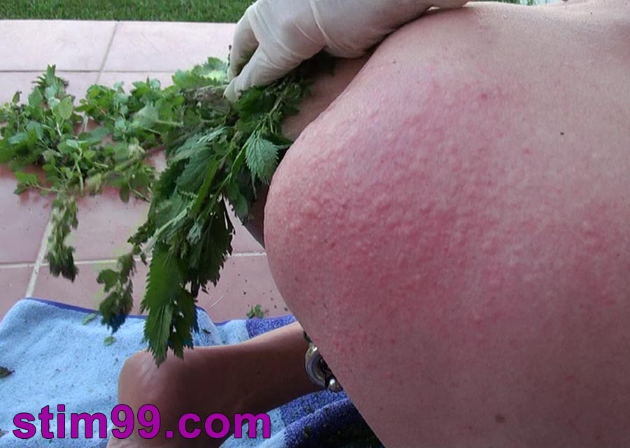 Extreme Anal with stinging nettles