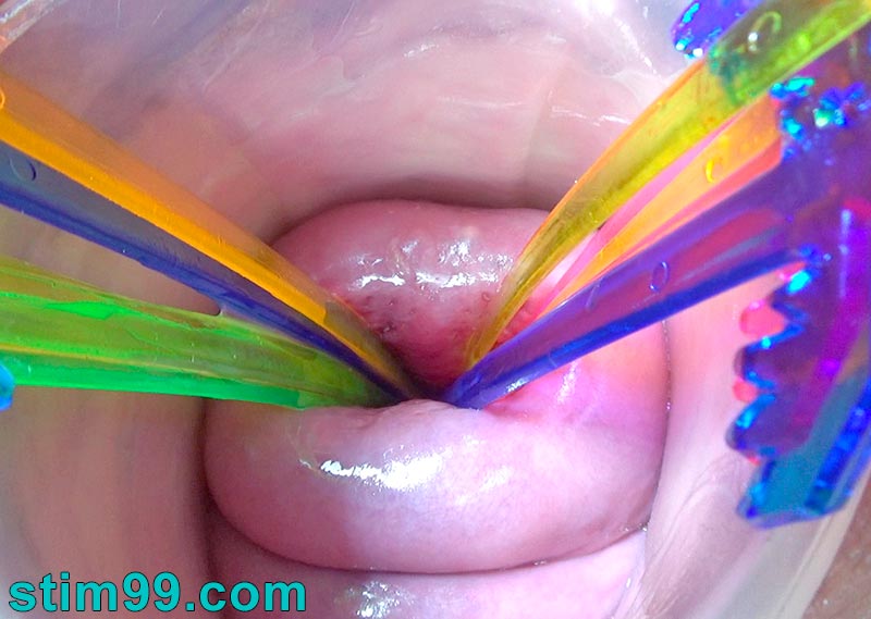 Cervix fucking with sextoys and showing the creampie of her prolapsed uterus