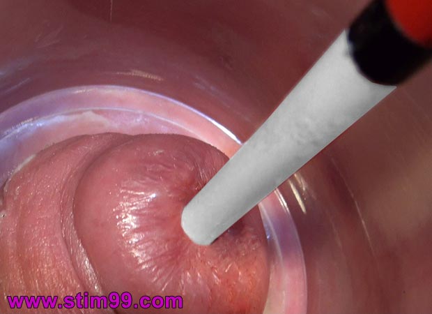 Cervix fucking until orgasm very deep inserting dildo and dilatation