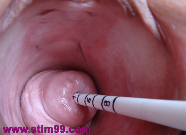 Real extreme cervix fucking with huge object very deep into uterus