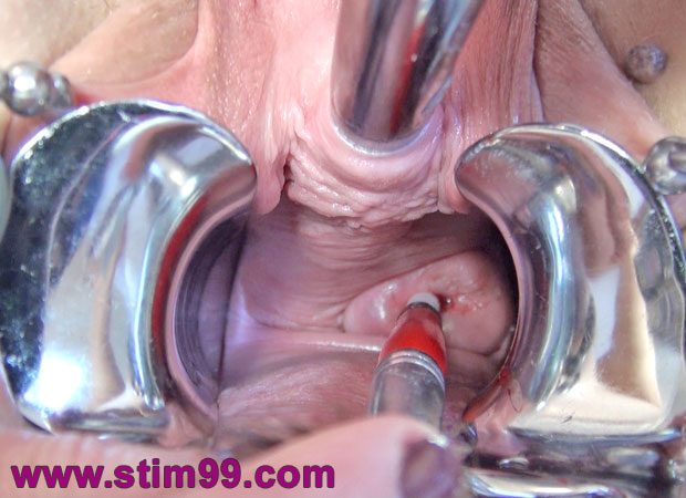 Extreme cervix fucking and peehole fucking insertion at the same time